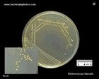 Enterococcus faecalis on CLED